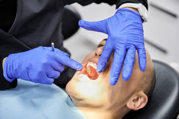 Best Emergency Wisdom Teeth Removal in Lexington, TN